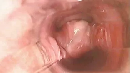 Bom pau apertado buraco menina em video amador nacional quente anal sexo